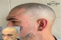Unveiling The Truth: Steve Austin's Baldness Decoded